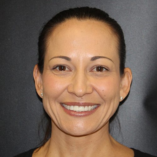 Kara Rentch DermaCare