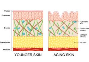 skin tightening procedure