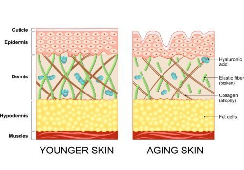skin tightening procedure