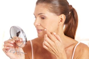 juvederm patient san diego