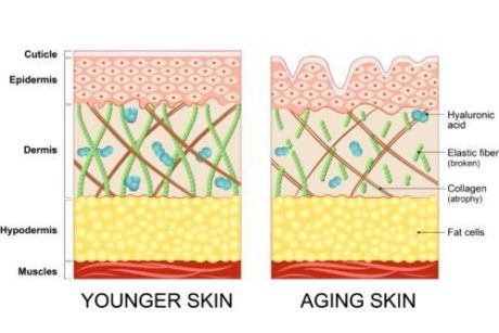 skin tightening procedure