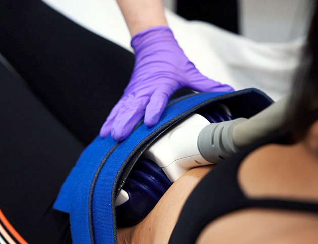 coolsculpting patient