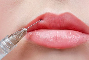lip fillers