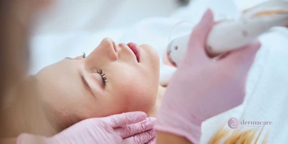 Best Microneedling San Diego
