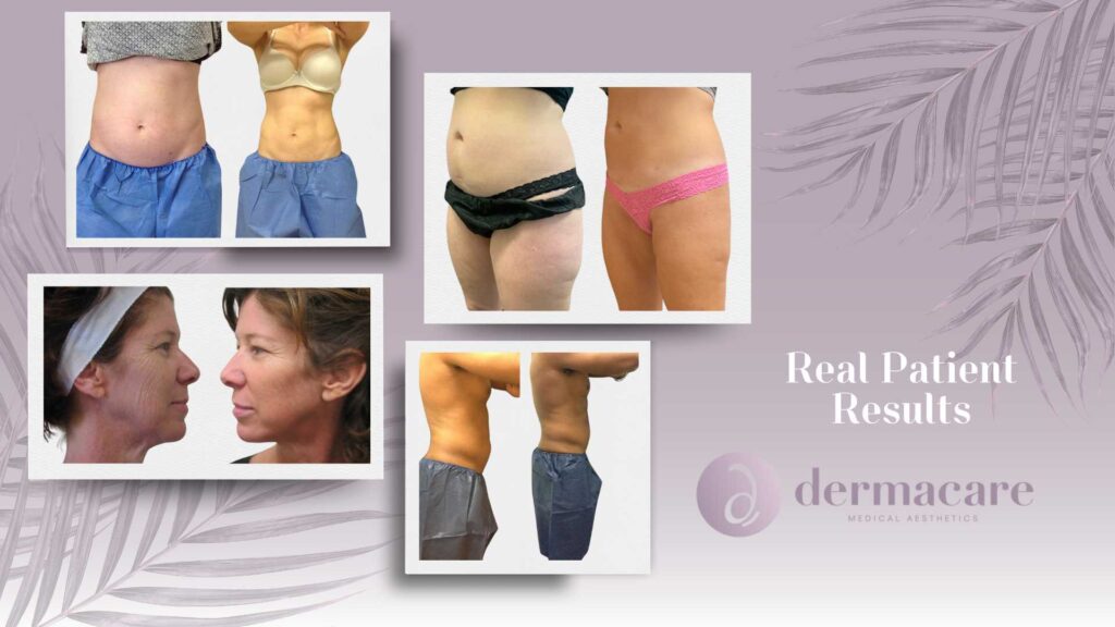 San Diego Body Contouring