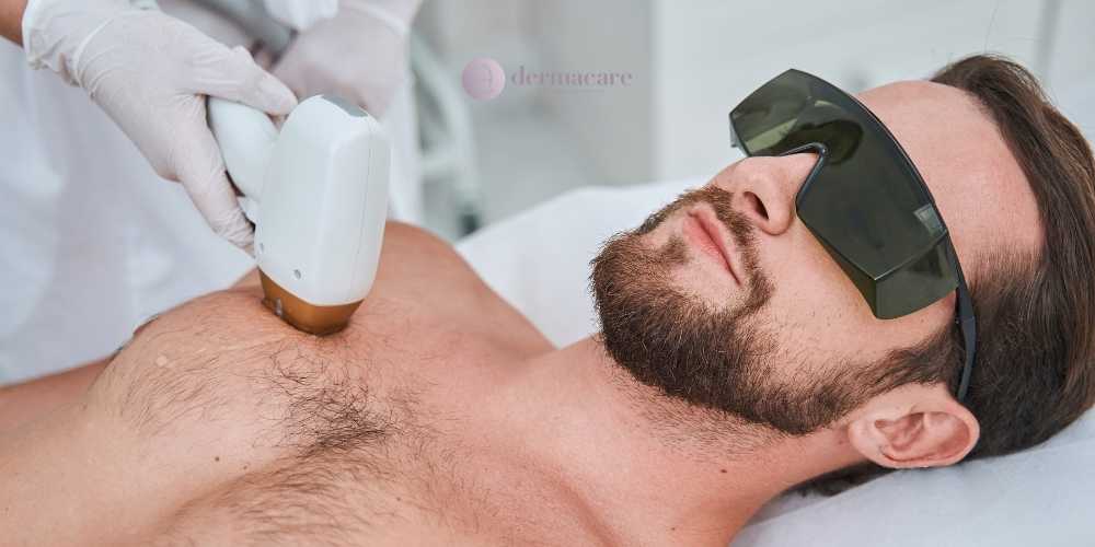 San Diego laser hair removal