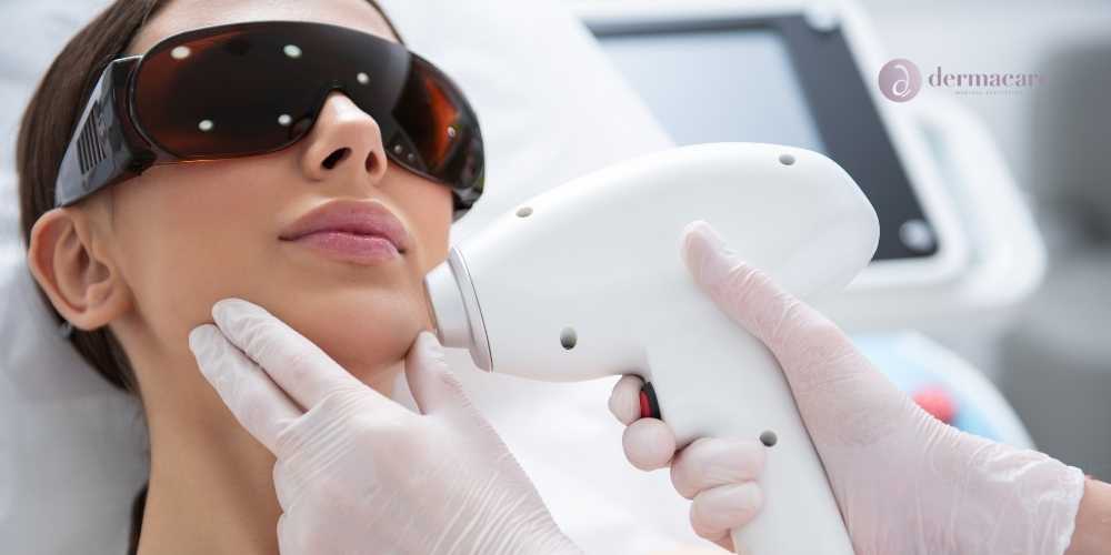 hair laser removal san diego
