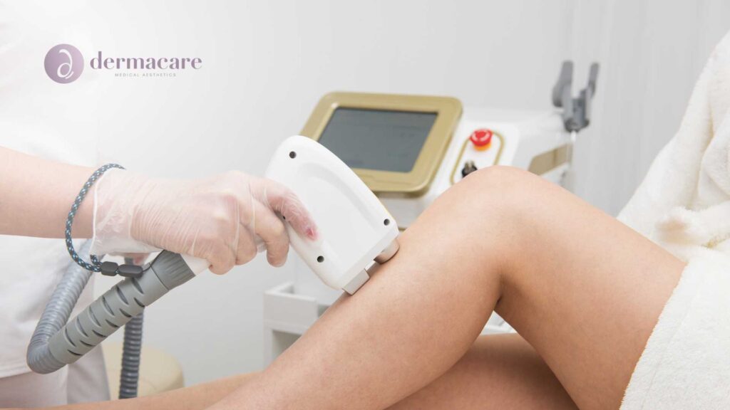 laser facial san diego