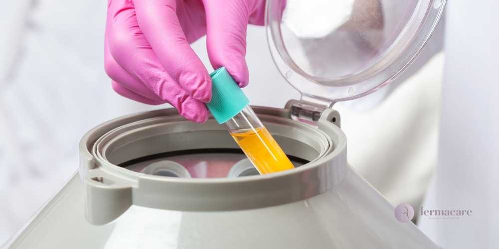 micro needling san diego
