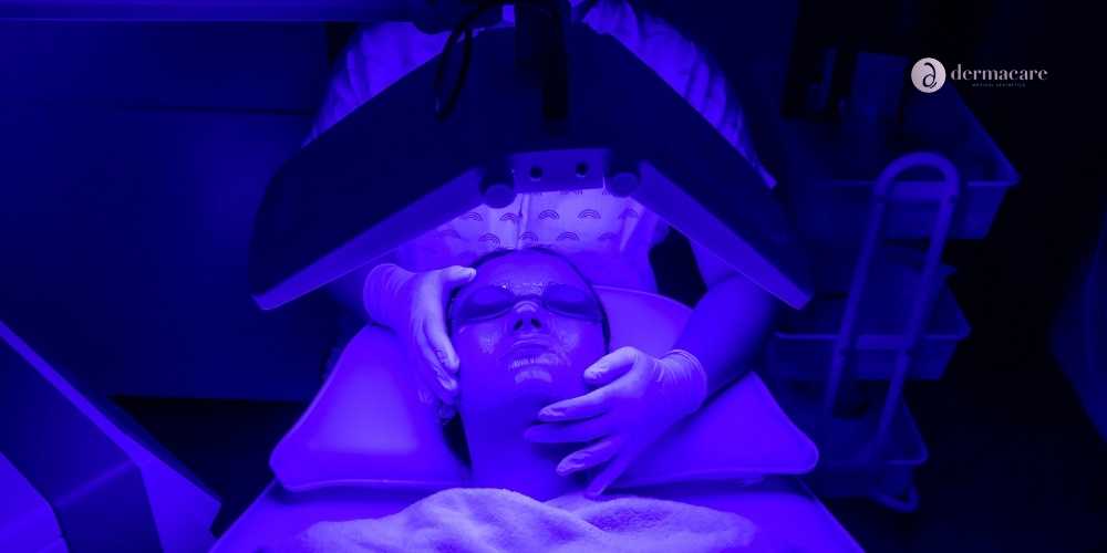 Blue Light Therapy Rancho Bernardo