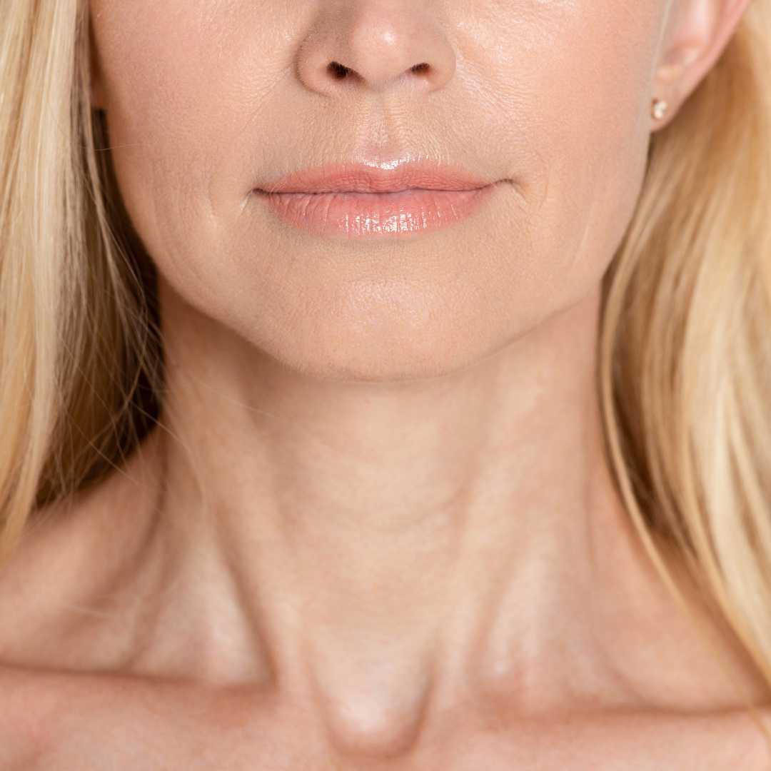 skin tightening face san diego